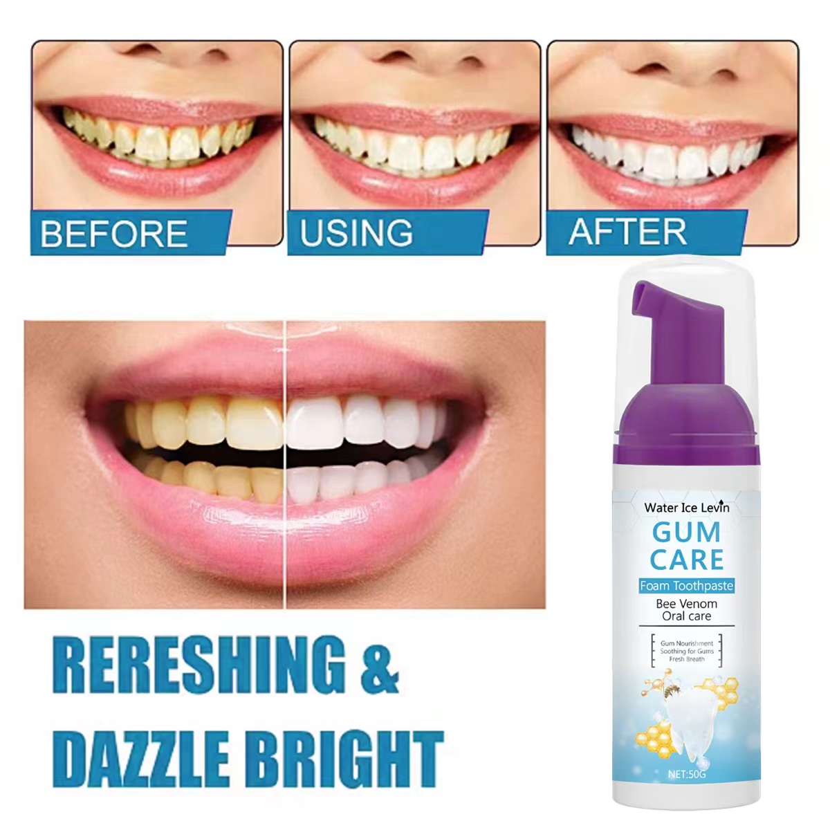 물얼음 레빈 잇몸 케어 폼 치약 (벌독 & 자일리톨 함 - Teeth Whitening Xylitol Gum 리뷰 및 가격