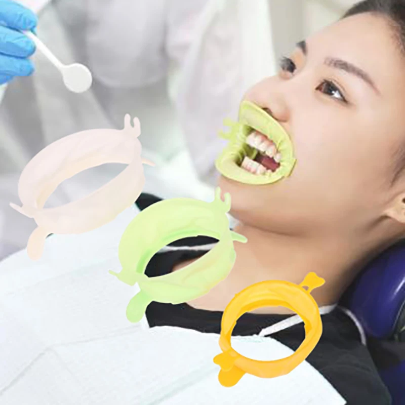 3Pcs S/M/L 치과 립 뺨 리트랙터 입 오프너 치 - Teeth Whitening Zoom 리뷰 및 가격