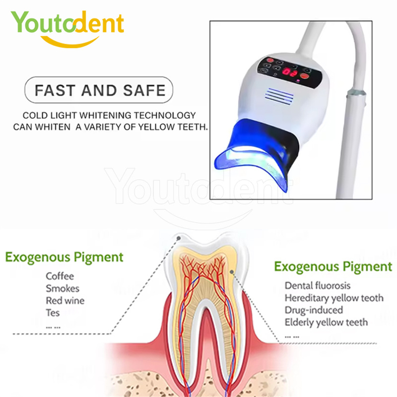 전문 치과용 3색 광 램프 치아 미백기 미백 촉진 장치 - Teeth Whitening With Led Light 리뷰 및 가격