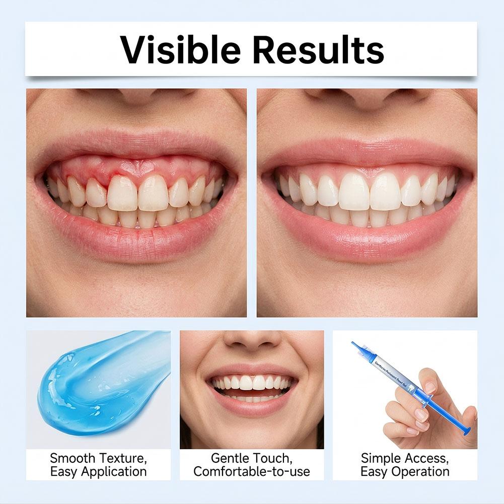 3개입 치아 미백용 하이드록시아파타이트 젤, 치석 제거 - Teeth Whitening Gum 리뷰 및 가격