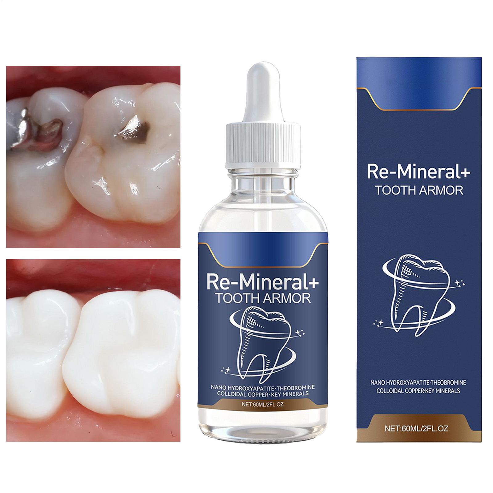60ml 치아 청소 액체는 치아 얼룩을 제거합니다. 여 - Teeth Whitening Gum 리뷰 및 가격