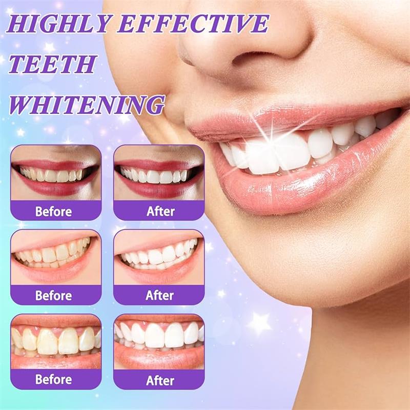 9D 퍼플 치아 미백 치약 무스, 누런 치아 및 플라그 - Remineralizing Toothpaste 리뷰 및 가격