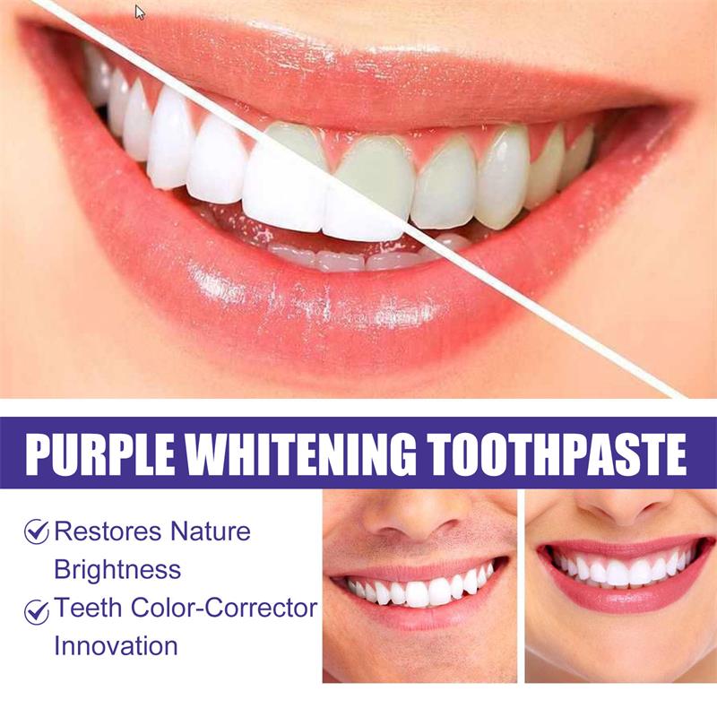 9D 퍼플 치아 미백 치약 무스, 누런 치아 및 플라그 - Remineralizing Toothpaste 리뷰 및 가격