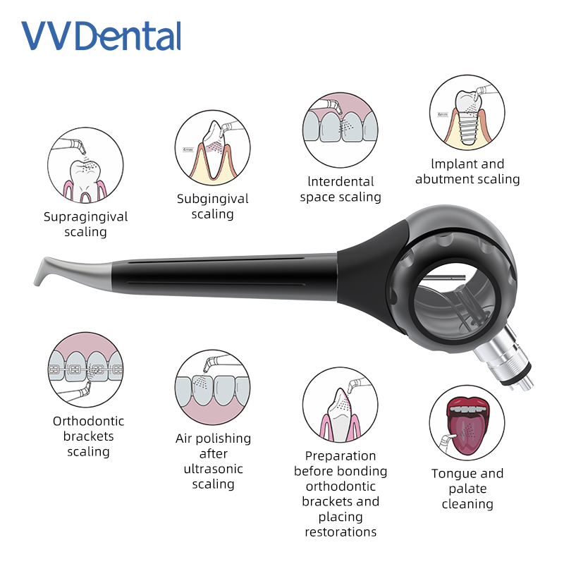 VVDental 에어 폴리셔 제트 에어 플로우 에어 구 - Colgate Whitening Teeth 리뷰 및 가격