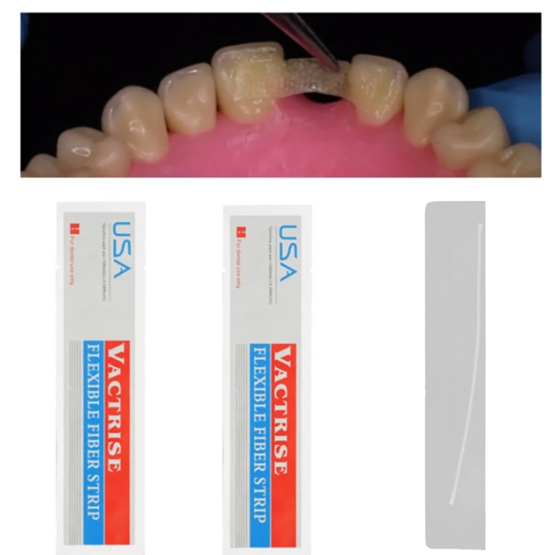 1개입 치과용 유연 섬유 스트립 글래스 스플린트 광중합 - Teeth Whitening Zoom 리뷰 및 가격